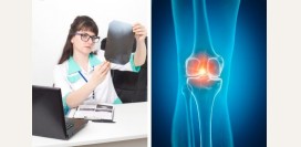 Артролог. Чем занимается данный специалист, какие исследования производит, какие патологии лечит?