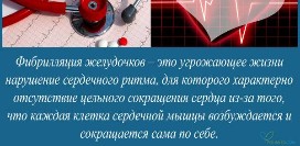 Фибрилляции желудочков, причины, симптомы, диагностика и лечение патологии