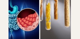 5 особенностей диагностики Целиакии