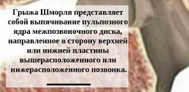 Грыжа Шморля причины появления. Патологии, вызывающие разрушение позвонков. Лечение грыжи Шморля
