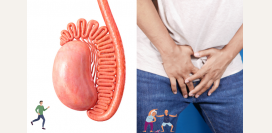 Водянка яичка (гидроцеле). Причины, симптомы, диагностика и лечение патологии