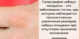 Гипертрофия небных миндалин. Причины, симптомы, диагностика и лечение патологии