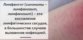 Лимфангит. Причины, симптомы, профилактика и лечение патологии