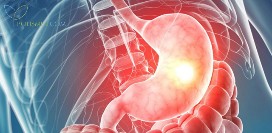 Аденокарцинома желудка. Причины, симптомы, диагностика и лечение патологии