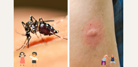 Эффективные средства от комаров и их укусов