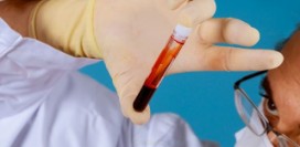 12 показателей биохимического анализа крови, которые должны знать все