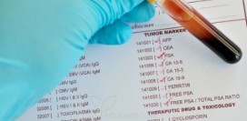 Онкомаркеры – следы опухолей в организме. Когда нужно сдавать анализ?