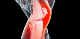 14 причин боли в коленях. Как определить этиологию и правильно начать восстановление?