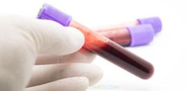 Развернутый биохимический анализ крови – 7 панелей: от ферритина до липидограммы