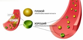Естественные механизмы чистки сосудов - как включить их в полную силу?