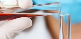 Разжижение крови естественными способами