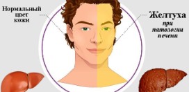 Кожа и слизистые оболочки как зеркало состояния печени