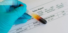 Альфа-фетопротеин (АФП) – о чем может рассказать анализ и его расшифровка