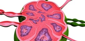 Увеличение лимфоузлов на шее, под мышкой, в паху. Причины и сопутствующие симптомы