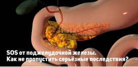 Поджелудочная железа – как не пропустить тревожные сигналы, которые подаёт орган и не допустить серьёзных последствий 