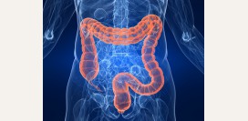 Неспецифический язвенный колит (НЯК) - причины, симптомы, диагностика и эффективное лечение