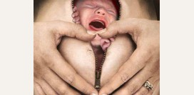 Кесарево сечение - показания для операции, противопоказания, критерии назначения, этапы операции, послеоперационный период, осложнения