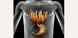 Изжога - причины, болезни при которых появляется изжога, современное лечение, изжога при беременности