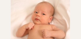 Кривошея - причины, признаки, методы лечения. Кривошея у новорожденных