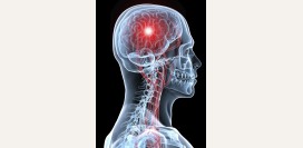 Инсульт - причины, симптомы, диагностика, современная диагностика, эффективное лечение, реабилитация и профилактика осложнений