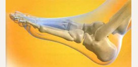 Болит стопа - причины: остеопороз, облитерирующий эндартериит, диабетическая стопа, подошвенный фасциит, пяточная шпора, бурсит стопы, плоскостопие, лигаментит, лигаментоз, травмы стопы, поперечное плоскостопие, панариций, подагра