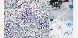 Могущественный пробиотик для здорового кишечника и запуска процесса омоложения. Выращиваем сами.