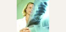 Рентген при туберкулезе - симптомы, признаки, описание рентгена при пневмонии