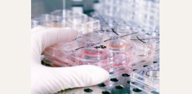 Липидограмма – анализ крови на холестерин. ЛПВП, ЛПНП, триглицериды - причины повышения показателей липидограммы. Коэффициент атерогенности, плохой и хороший холестерин