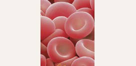 Анемия связанная с нарушением обмена порфиринов