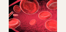 Фолиеводефицитная анемия – причины, симптомы, диагностика и лечение