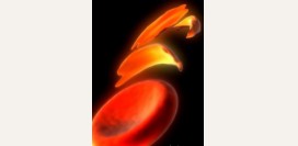 Серповидноклеточная анемия – причины, симптомы, лечение