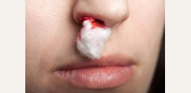 Хронические кровотечения