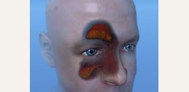 Фронтит - причины, симптомы и признаки, диагностика и лечение заболевания