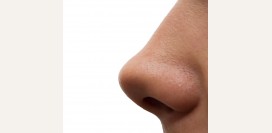 Искривление носовой перегородки – симптомы, признаки, диагностика, причины. Лечение искривления: показания, противопоказания к операции