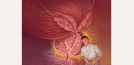 Везикулит - причины, признаки, симптомы, диагностика и лечение. Острый и хронический везикулит и его лечение