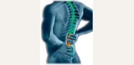 Люмбаго - симптомы, причины, диагностика и лечение. Как лечить люмбаго: гимнастика, упражнения, массаж