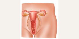 Вульвовагинит - причины, симптомы, признаки, диагностика и лечение. Острый, хронический, атрофический, специфические виды вульвовагинита. Бактериальный, кандидозный, трихомонадный уретрит