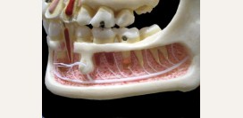 Что делать после удаления зуба?