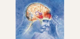 Мигрень - причины, симптомы, диагностика и лечение болезни