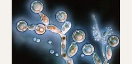 Кандидоз полости рта. Причины, симптомы и признаки, лечение кандидоза.