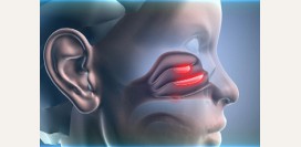 Полипы в носу - причины, симптомы и признаки, диагностика и лечение. Удаление полипов в носу: операция, удаление лазером, шейвером, эндоскопическое удаление