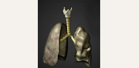 Трахеит. Причины, симптомы, диагностика и лечение болезни. Профилактика и эффективное лечение трахеита у детей и взрослых. 