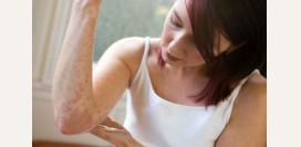 Псориаз. Виды, причины, симптомы и признаки, диагностика и лечение заболевания