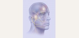 Неврит лицевого нерва. Причины, симптомы и признаки, диагностика, лечение. 