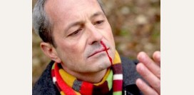 Кровь из носа у взрослого, у детей, при беременности, причины, симптомы, что делать? Носовое кровотечение первая помощь. 