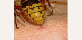 Укус пчелы, осы, что делать? Первая помощь при укусе пчелы, осы, шершня.