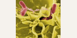 Сальмонеллез. Симптомы, причины, диагностика и лечение болезни.