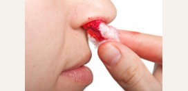 Кровотечение - как оказать помощь? Классификация, виды, наружное, внутреннее, артериальное, венозное, капиллярное, симптомы и признаки, способы остановки кровотечения, оказание первой помощи. Жгут при кровотечении. 