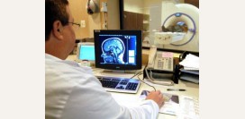 Ишемический инсульт и новое компьютерное приложение