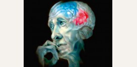Болезнь Альцгеймера - причины, симптомы, диагностика и лечение